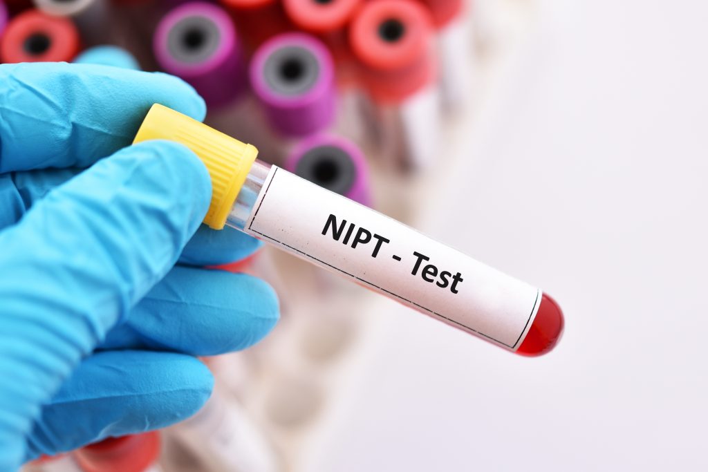 Blutprobenröhrchen für NIPT-Test oder nicht-invasive pränatale Tests
